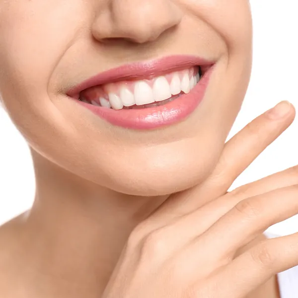 Close-up of a white smile after teeth whitening